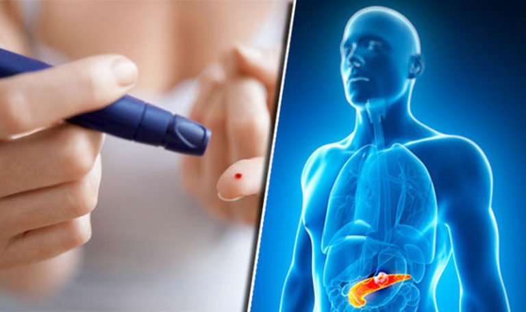 Konsumsi Minyak Sawit Bikin Diabetes? Ini Penjelasan yang Mengejutkan!